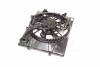 Дифузор радіатора охолодження двигуна у зборі (25380-3R610) Mobis Hyundai/Kia/Mobis 253803R610 (фото 4)